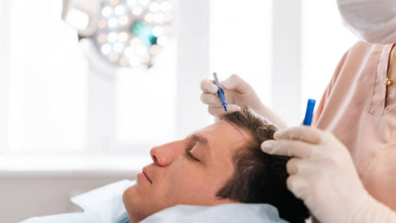 How Hair Transplants in Riyadh Are Helping People Rediscover Their Youth