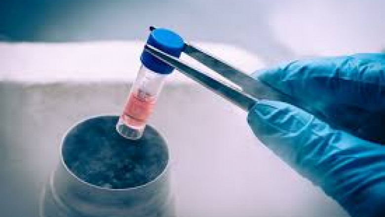 Cell Cryopreservation Market Estimated to Witness High Growth Owing to Automated Vitrification