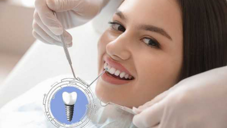 Why Glasgow Residents Prefer Fixed Tooth Restorations