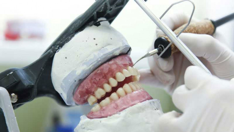 The Dental Lab Market: Advancing Technology and Transforming Smiles