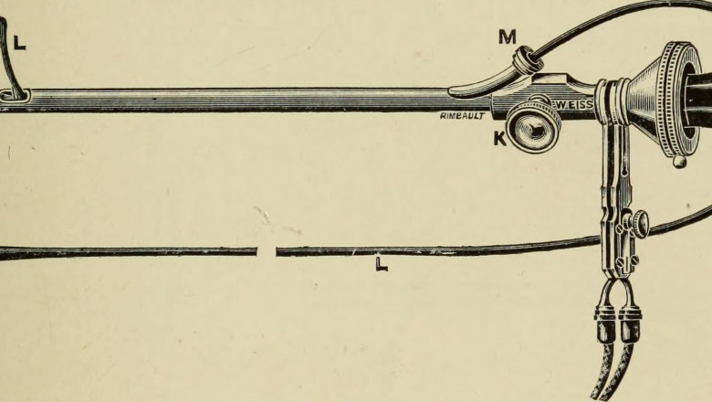 Shining a Light on the Cystoscope Market: Trends, Innovations, and Growth