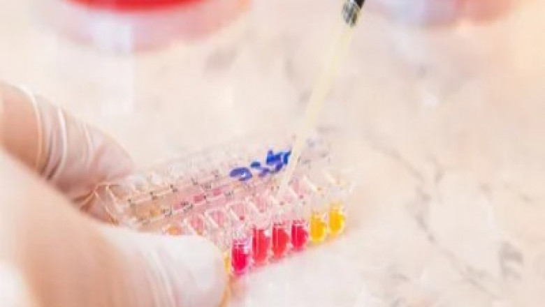 Mycoplasma Diagnostics: Techniques, Applications, and Advancements