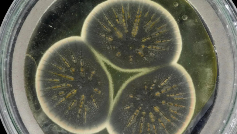 Penicillin Drug Market to Surge with Advanced Fermentation Technology