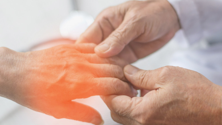 "Peripheral Neuritis Treatment Market Attracts Increased Investment as Demand Rises"