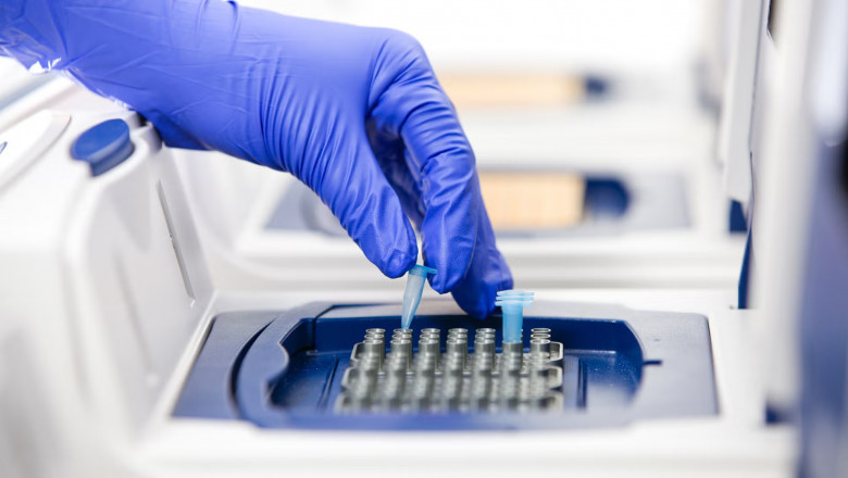 Unveiling the Potential of Immune Repertoire Sequencing in Advancing Immunology Research