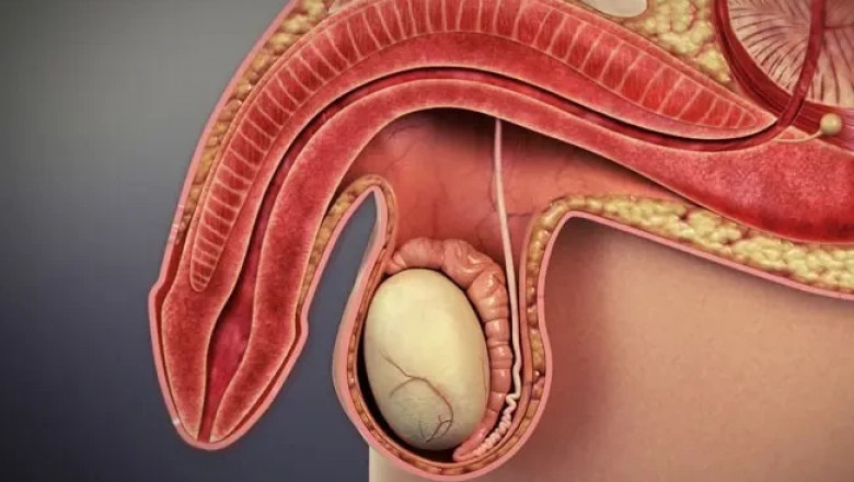 Ayurvedic Treatment for Erectile Dysfunction (ED): Herbs and Therapies for Enhanced Performance