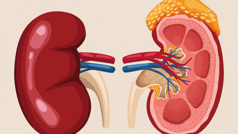 Ayurvedic Treatment for Kidney Swelling: Natural Remedies That Work