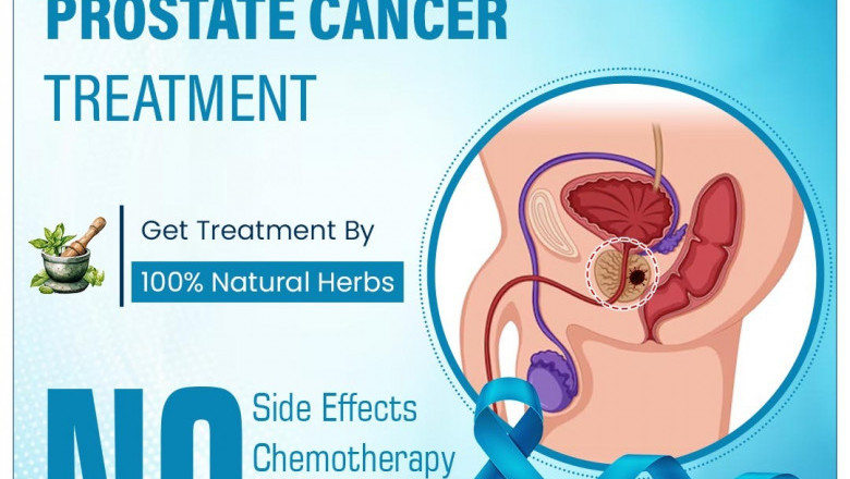 Best Prostate Cancer Treatment Hospital in Bangalore