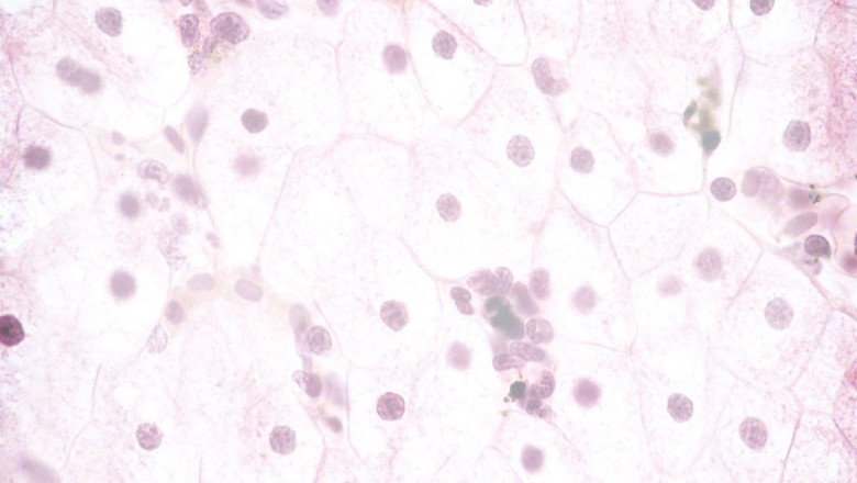 Histology And Cytology Market Set to Grow on AI-Assisted Pathology