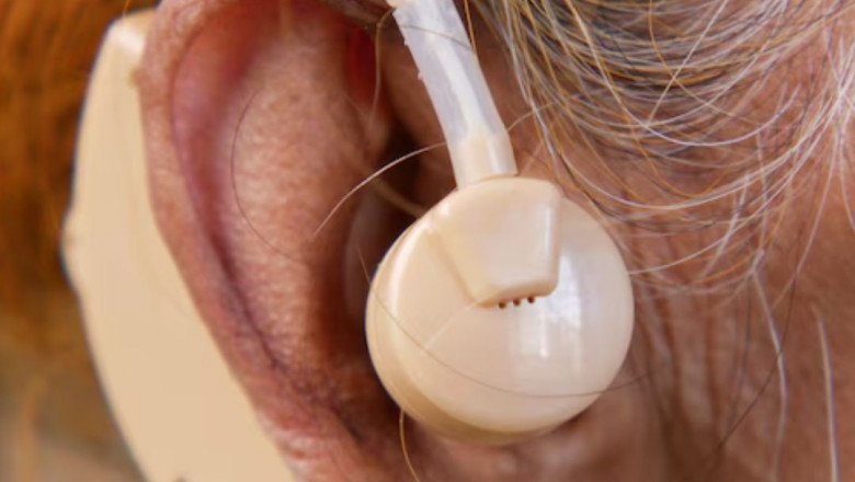 Basics of Hearing Loss: What Everyone Should Understand