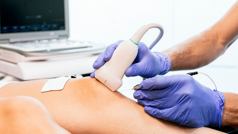 Viscosupplementation Market to Witness Growth via Novel Hyaluronic Acid Formulations