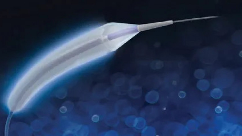 Drug Eluting Balloon Market to Grow with Polymer-Free Coatings