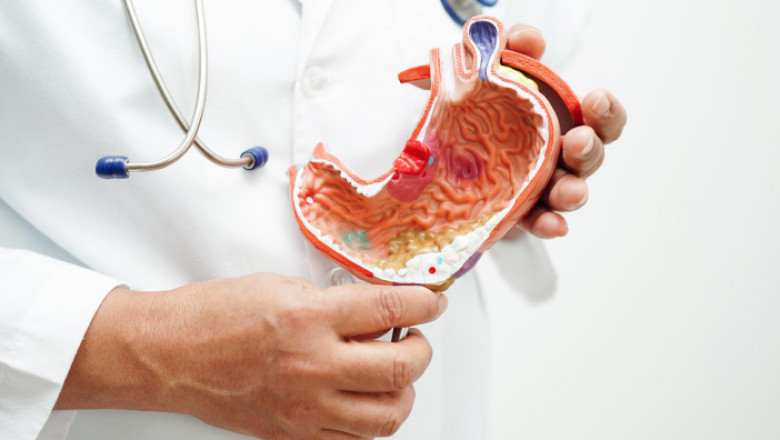 Peptic Ulcer Drugs Market Surges After Regulatory Milestones
