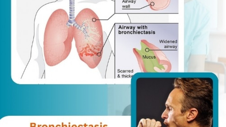 Bronchiectasis Symptoms Explained Clearly: What to Watch For and Why It Matters