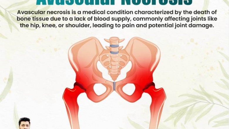 Trending Now: Ayurvedic Bone Regeneration Therapies for AVN (2025)