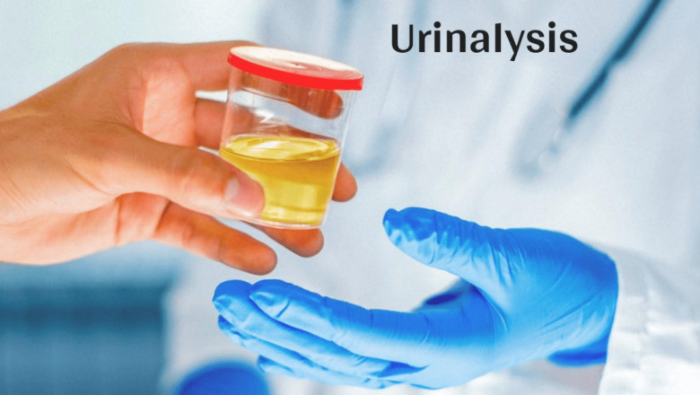 Urinalysis Market Report 2028: Insights and Strategic Imperatives