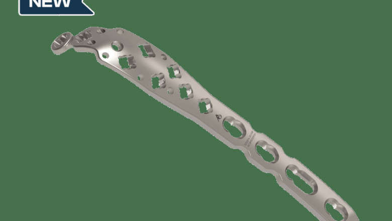 High-Quality Micro Plating Suppliers for Industrial Applications