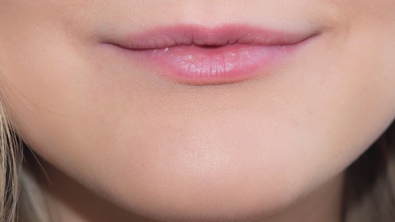 Lip Filler: Your Guide to Adding Volume to Your Lips in Ottawa