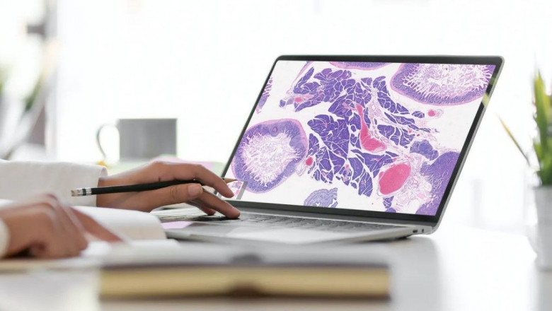 AI-based Digital Pathology Market Forecast and Growth Outlook 2025–2032