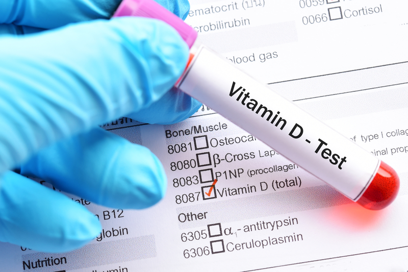 Vitamin D Test: Assessing the Sunshine Vitamin for Health and Well-being