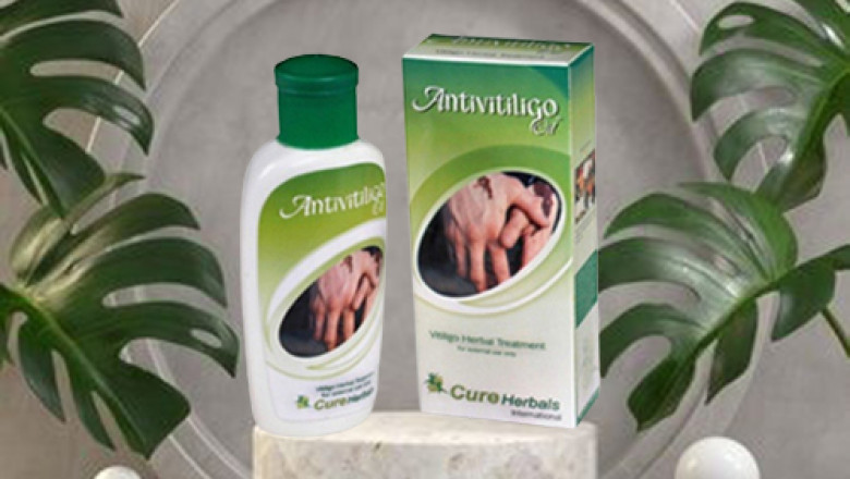 Get Customized Herbal Solutions for Vitiligo
