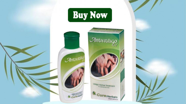 The Impact of Lifestyle Changes and Herbal Treatments on Vitiligo