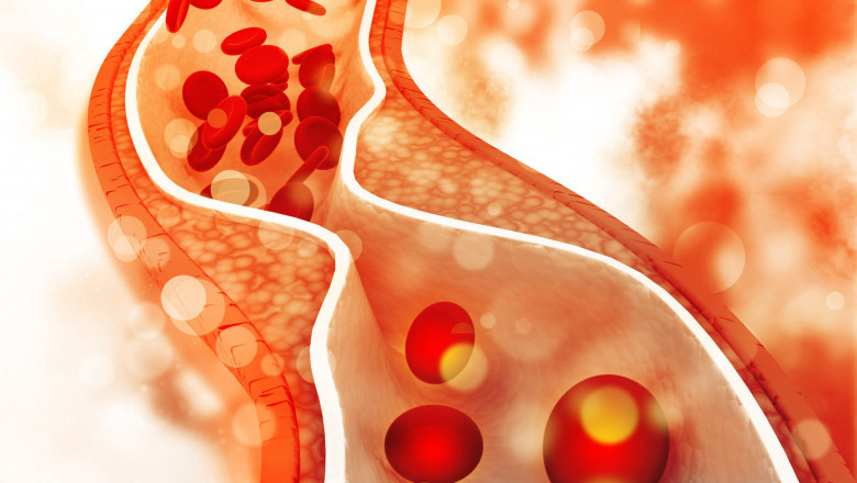 The Benefits of Stem Cell Therapy in Sports Medicine