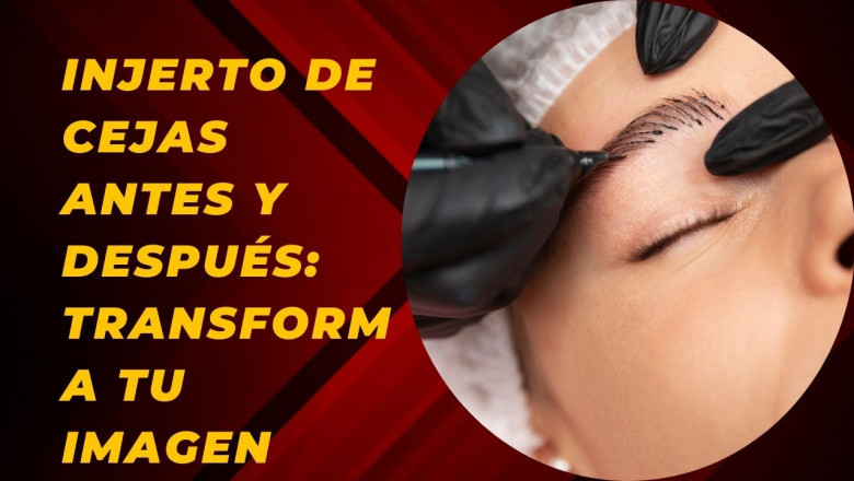 Injerto de Cejas Antes y Después: Transforma tu Imagen