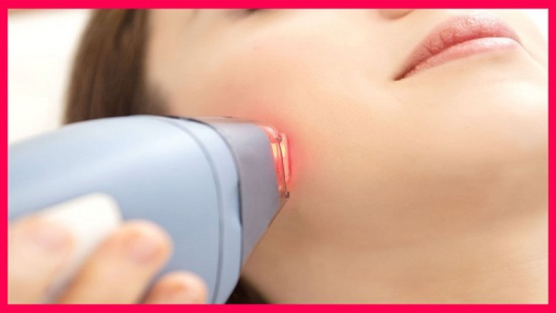 Non-Invasive Revolution: The Aesthetic Lasers Market Report