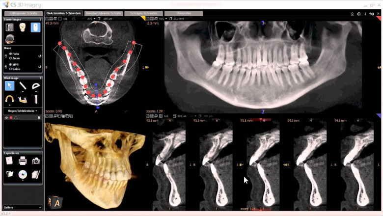 Exploring the Growth of the CBCT Dental Imaging Market