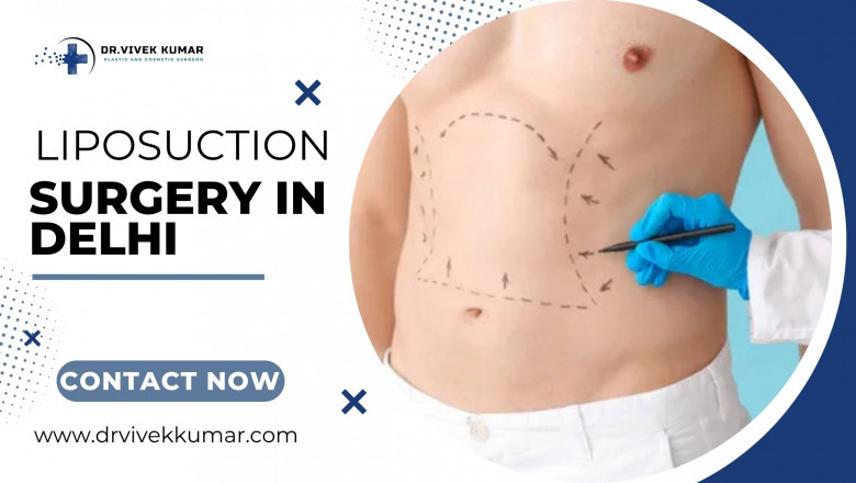 Best Liposuction Surgery in Delhi: Get the Body You Desire with Expert Care