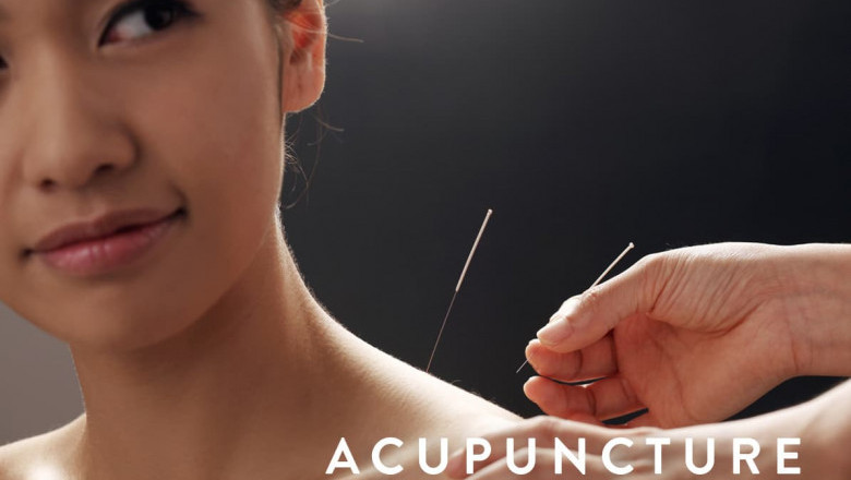 Acupuncture Thornhill