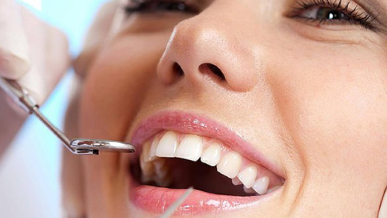 Enhance Your Smile with Cosmetic Dentistry in Odessa: Achieve Confidence Through Beautiful Teeth