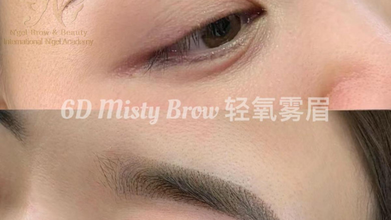 Restore Radiance & Confidence: Best Facial & Hairline Treatments in Singapore