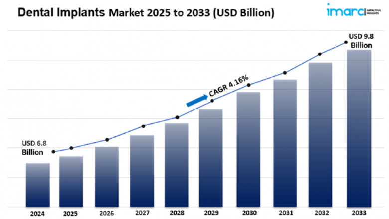 Dental Implants Market Size Growth & Analysis Report 2025