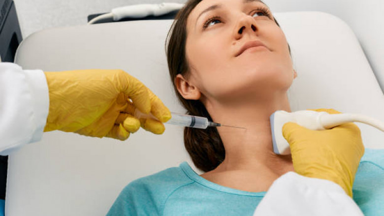 Everything You Need to Know About Belkyra Kybella Treatment