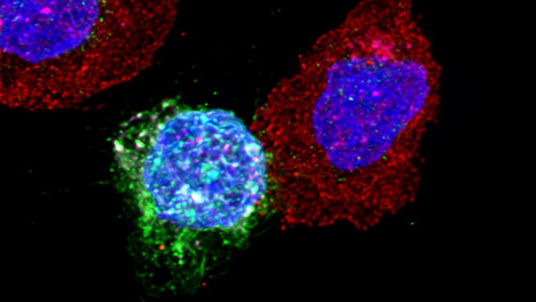 Idiopathic CD4+ Lymphocytopenia Market Growth and Opportunities