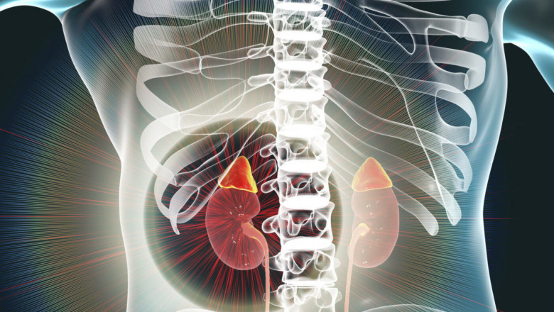 Pheochromocytoma Treatment Market Outlook and Growth Forecast