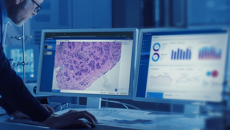 AI-based Digital Pathology Market Growth and Industry Outlook 2025-2032