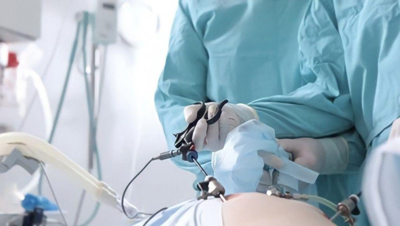The Future of Minimally Invasive Surgery: Laparoscopic Devices Market Forecast to 2031