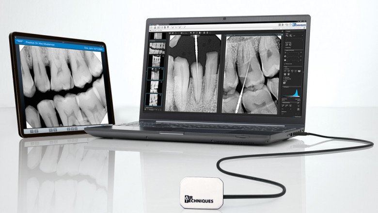 endodoncia